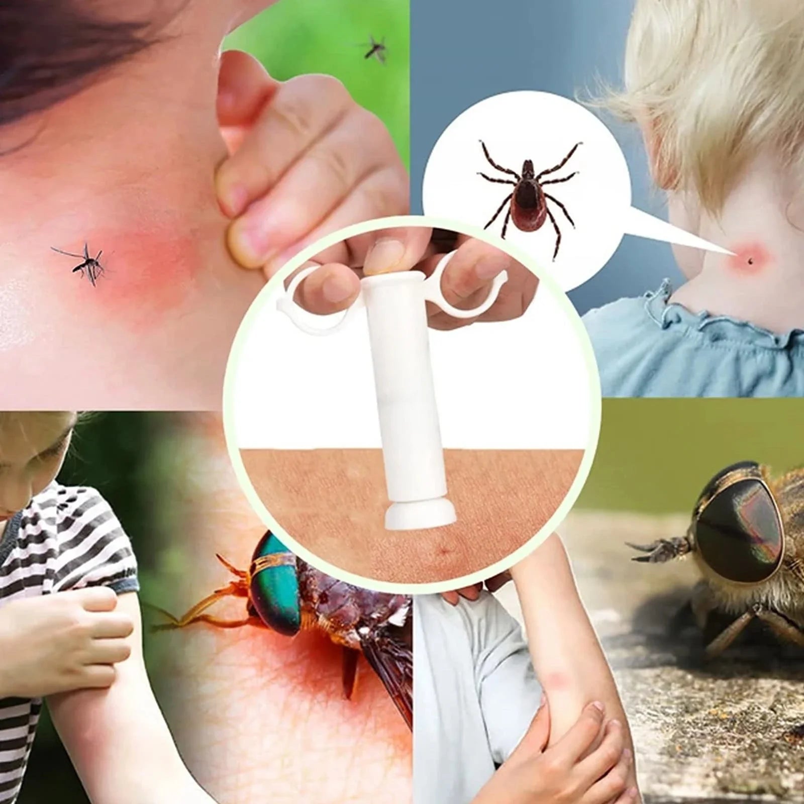 Bug-Bite Suction Tool